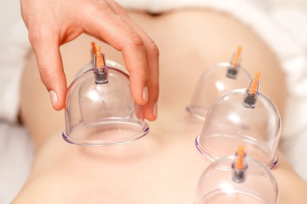 Cupping - Add On To Any Service