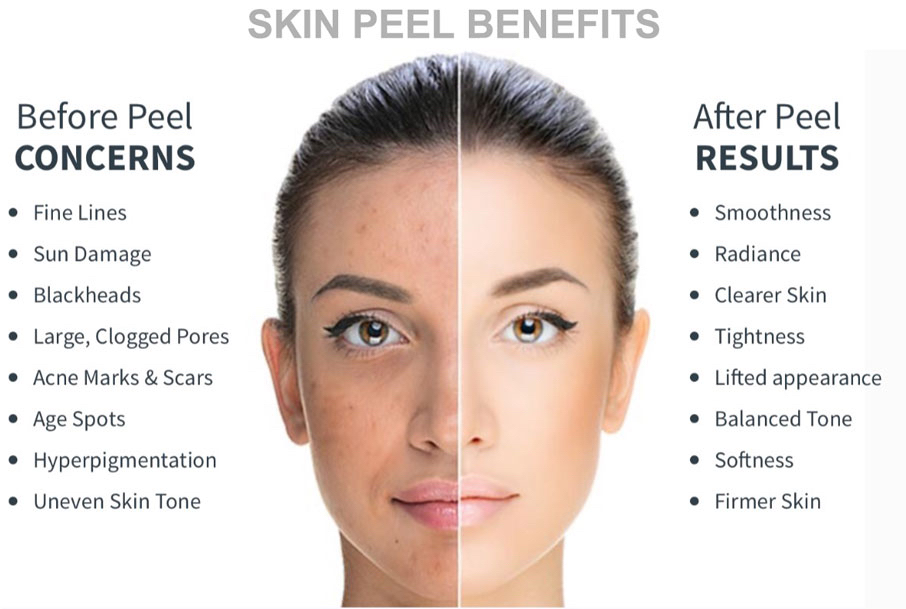 Oxygenation Peel at Primal Esthetics & Wellness in Siloam Springs, AR