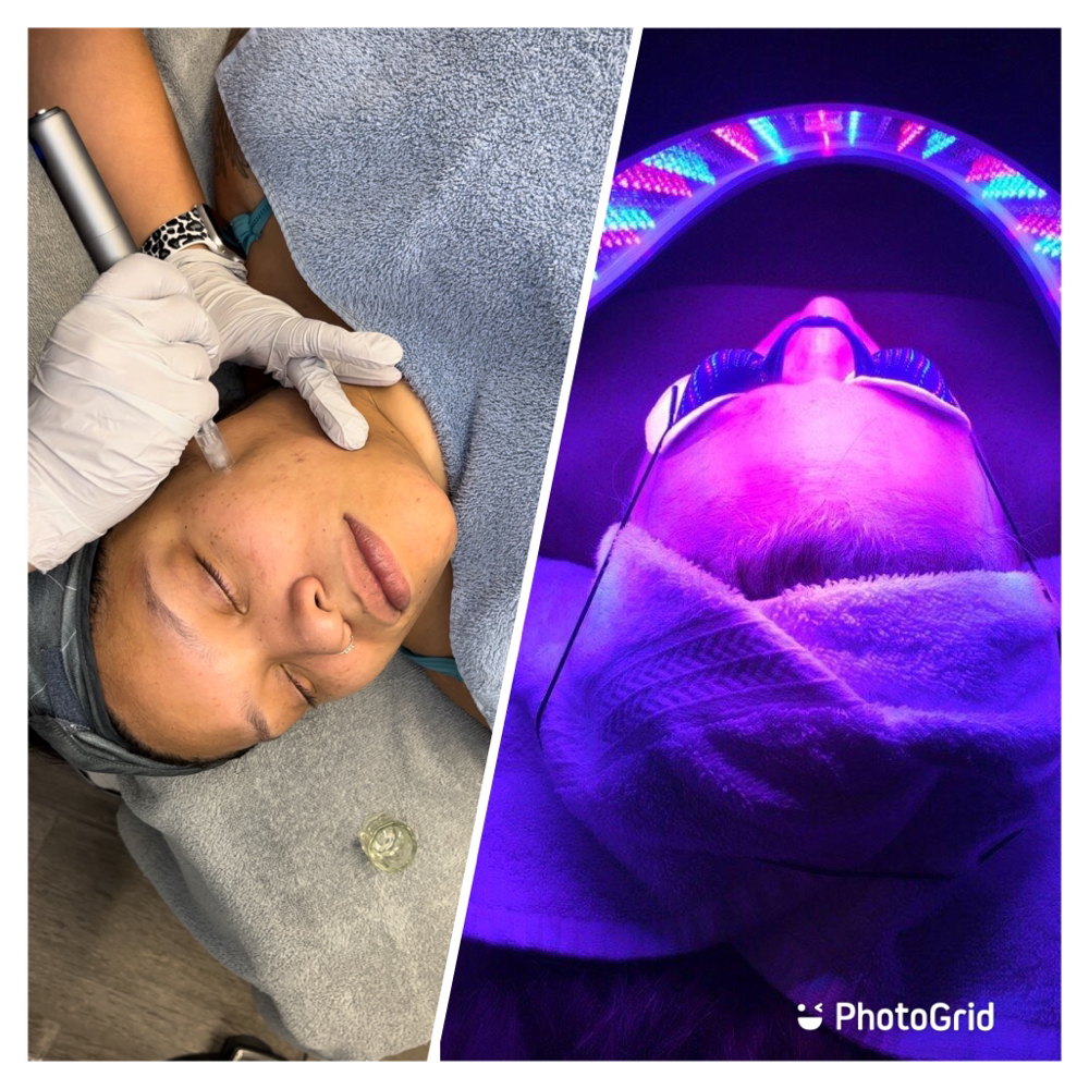 Nanofusion And Light Therapy