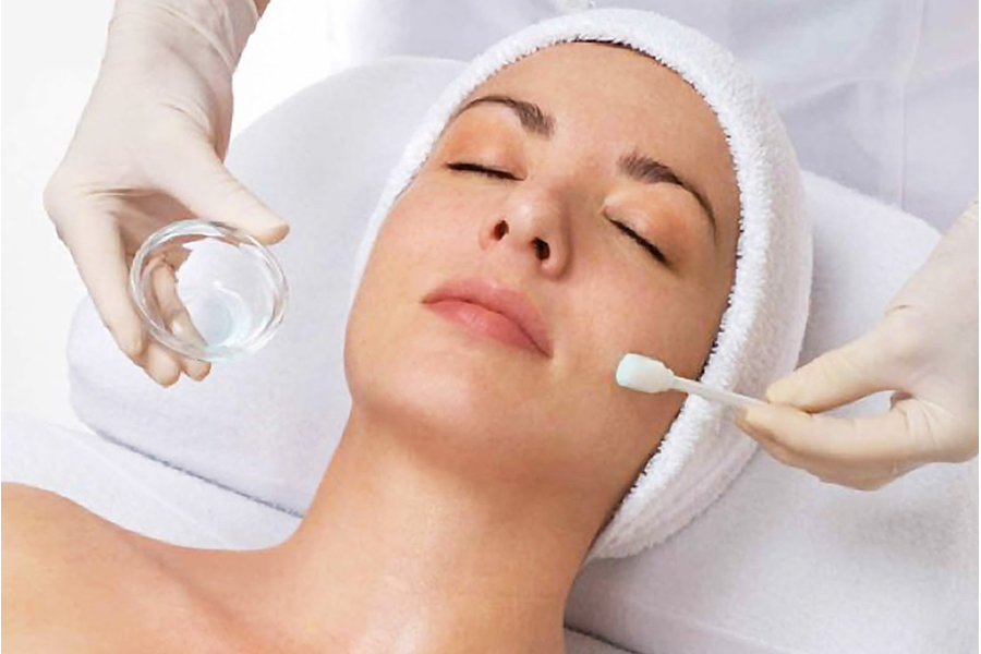 Add-on Chemical Peel