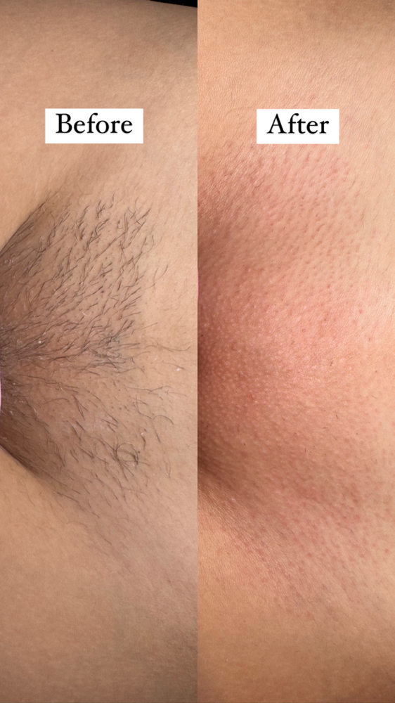 Brazilian Wax at Babysk.n in Loving, NM