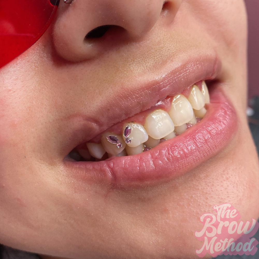 Butterfly Tooth Gem Design 🦋