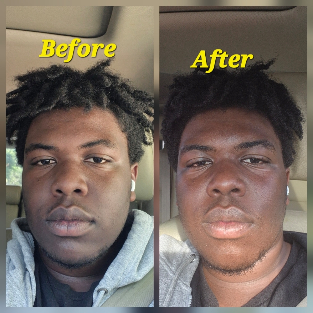 Teen Glow & Clear Facial at JUST BEAUTIFUL SKIN in Goose Creek, SC