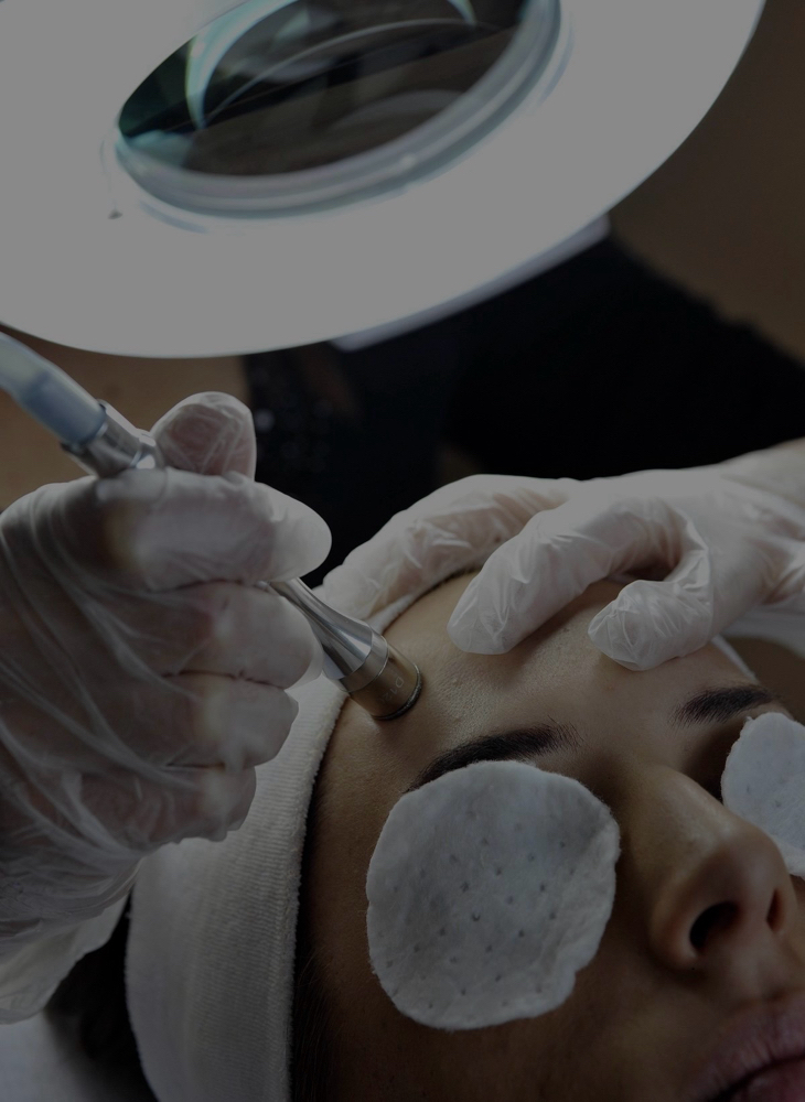 Microdermabrasion Facial