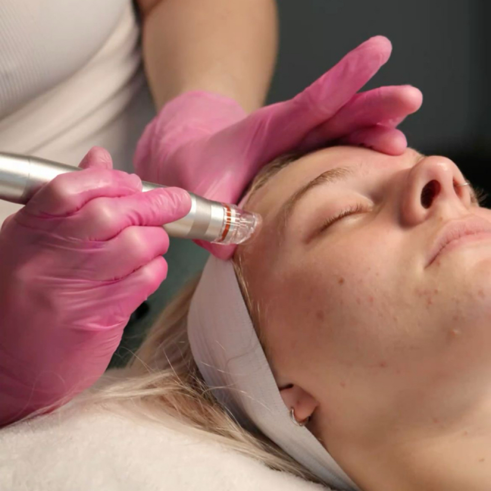 🫧HYDRO FACIAL🫧 at Precision skin and Wellness Lab in Tallahassee, FL