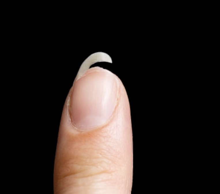 Nail Fix *Add On*