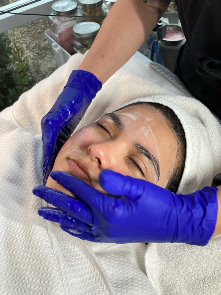 Dermaplaning With Enzyme Peel