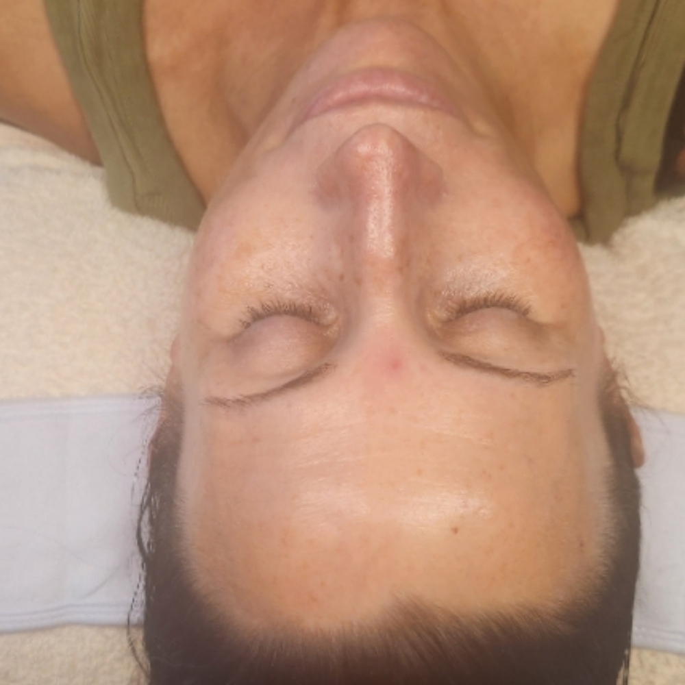 🫧HydraGlow Facial 🥥 at C|E Esthetics in Moore, OK