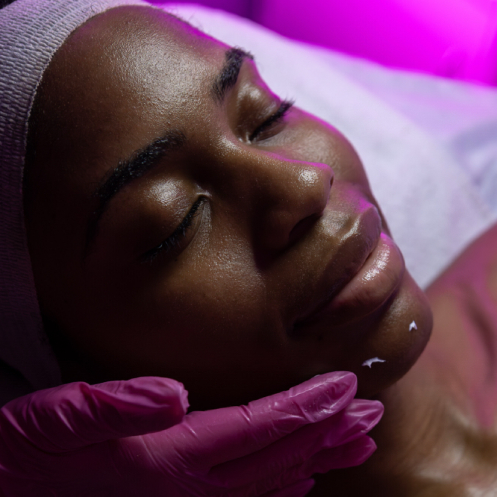 Chemical Peel at Maryna Skin Studio in Chicago, IL