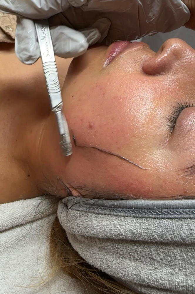 Dermaplane Facial