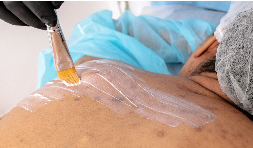 Back Peel Face Reality