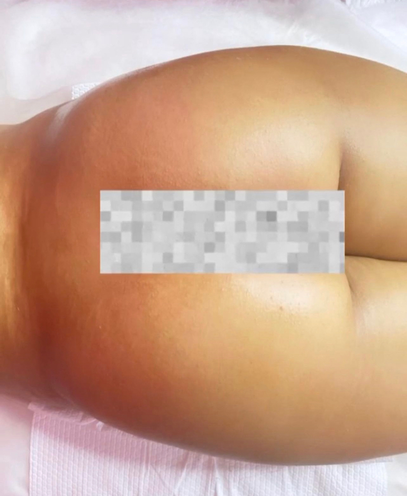 Full Butt