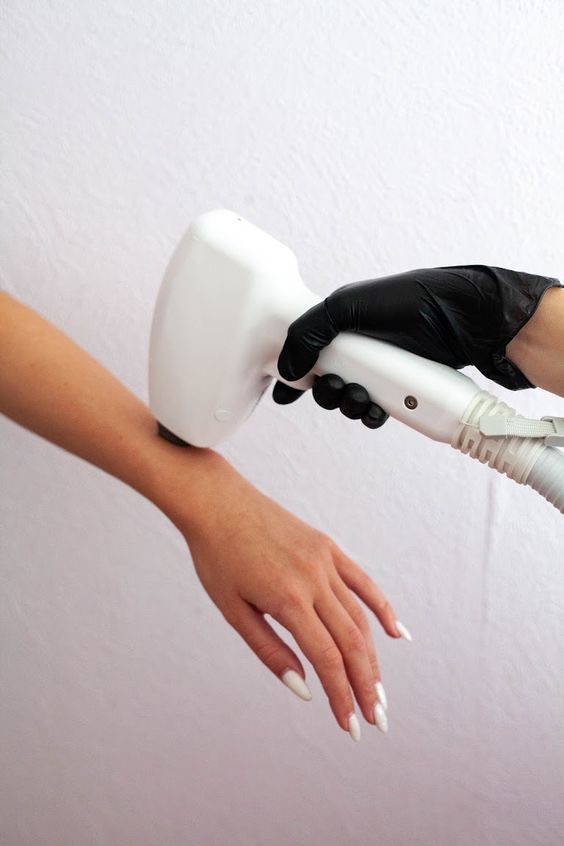 5 Sesiones de Dep. Láser Manos at LeBeau Esthétique in Humacao, PR