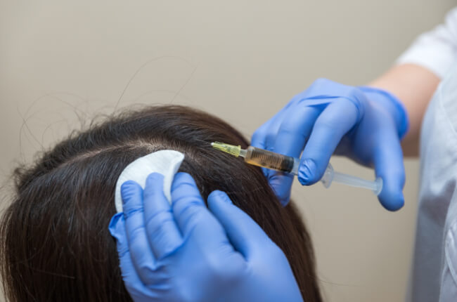 PRF For Hair Restoration