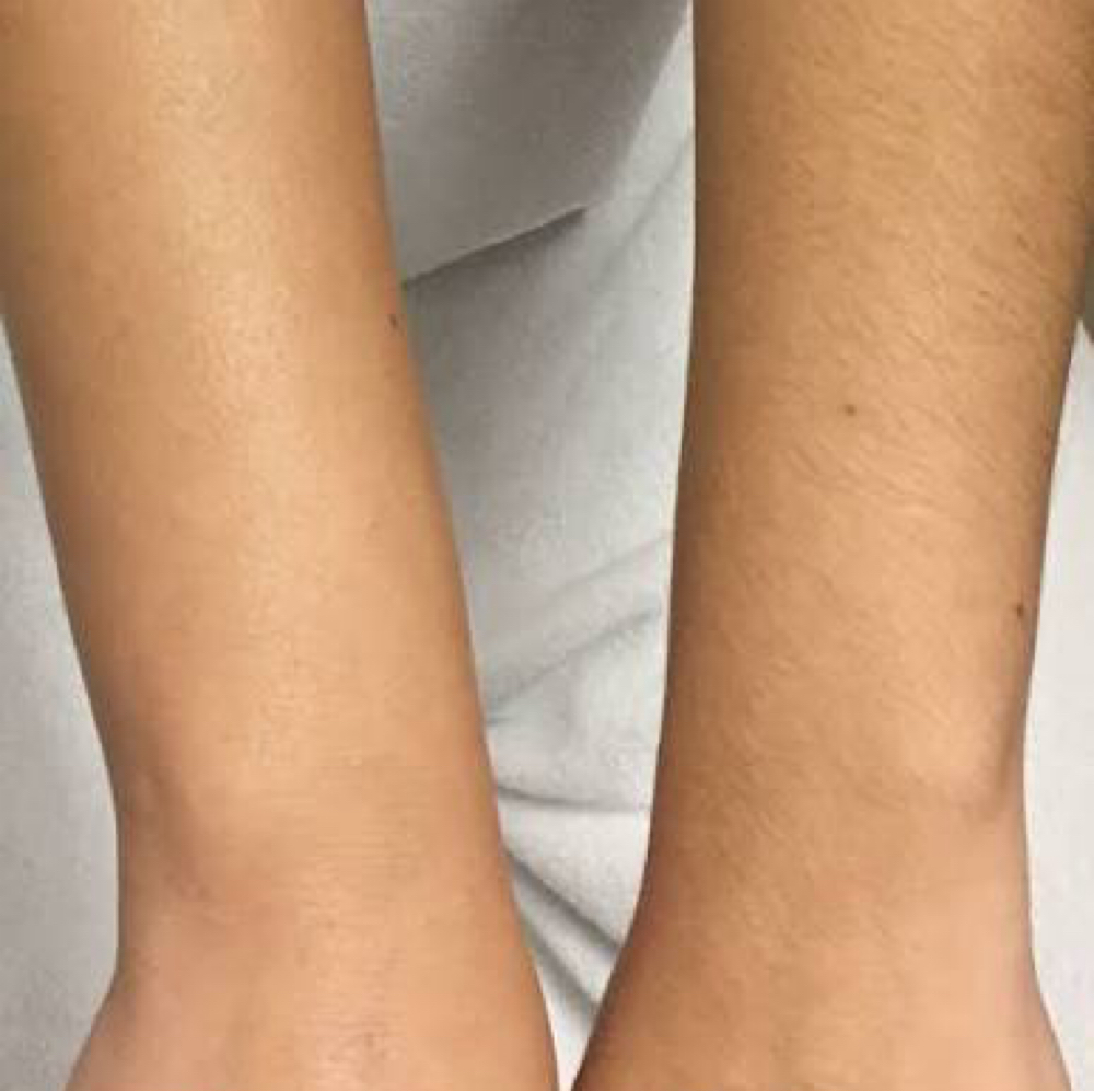 Half Arm Wax at Angelic Skin & Body in Oak Park, IL