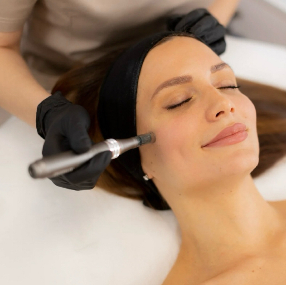 Microneedling (6 Months) at Zentique Aesthetics in Las Vegas, NV