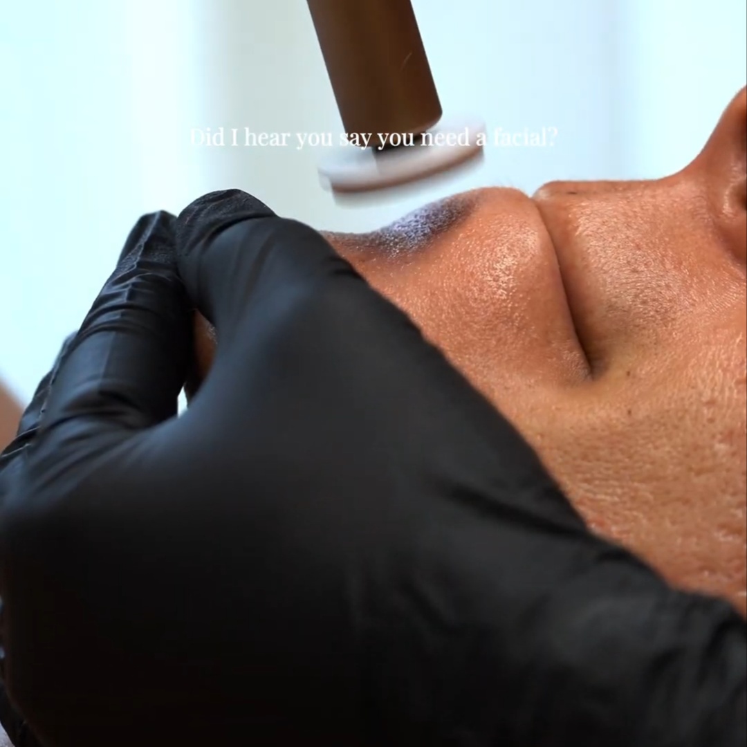 A1 Microchanneling Facial at Stephs A1 Beauty Bar in Southwest Ranches, FL