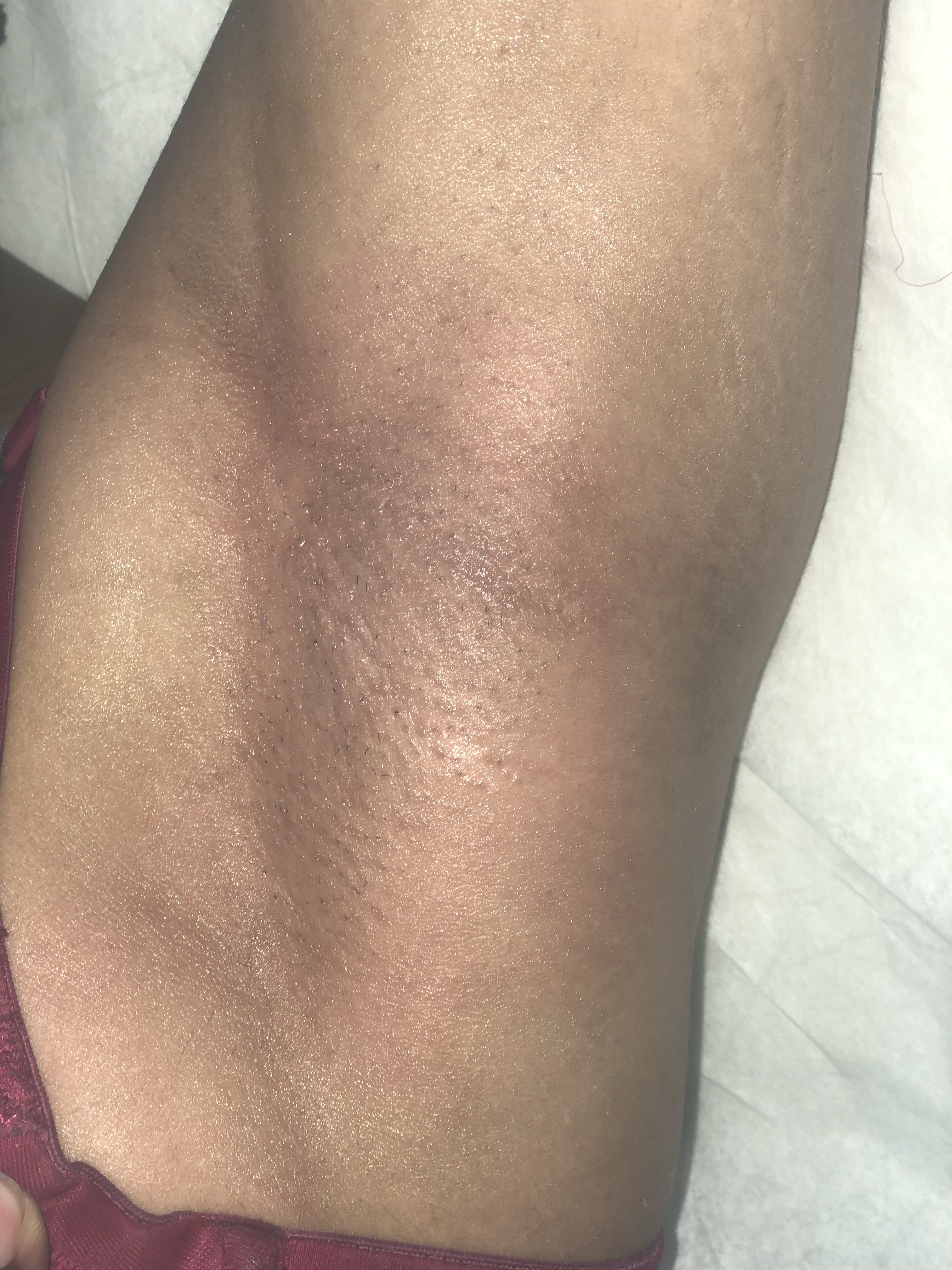 Beyond Waxing “under Arms”