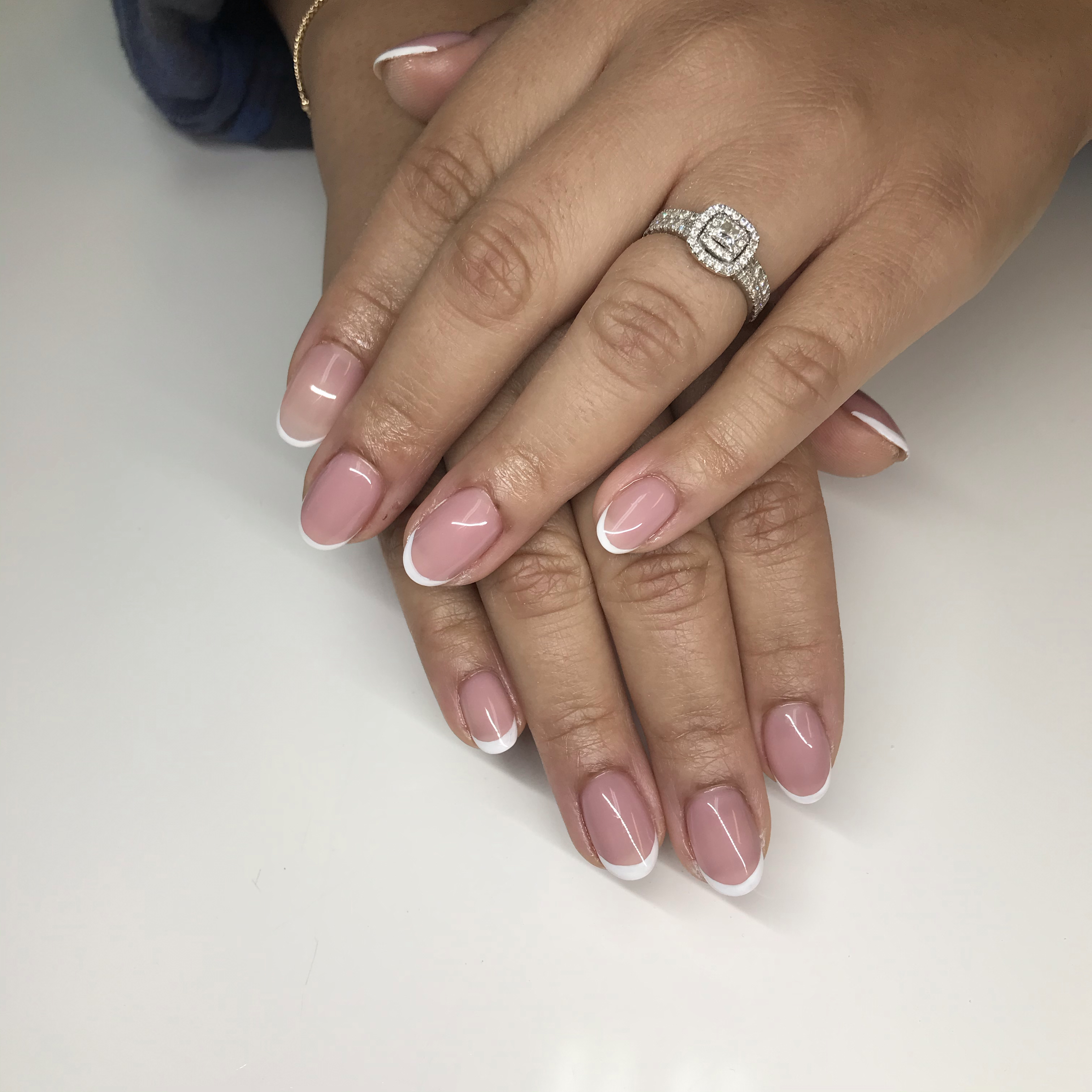 Gel Fill