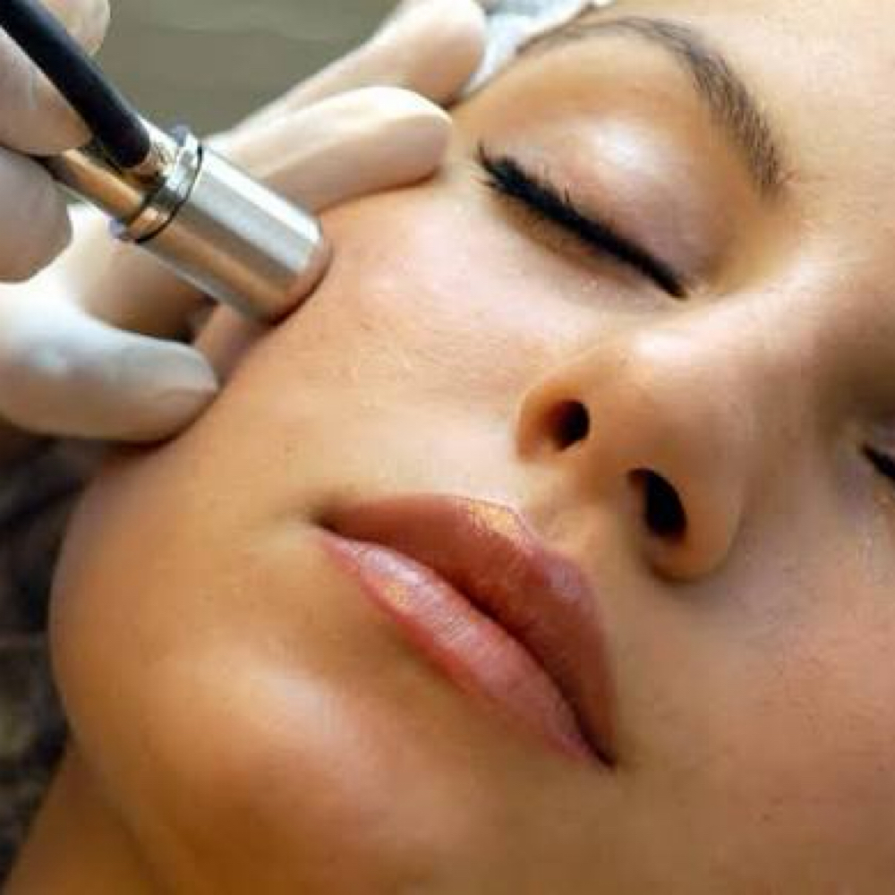 Microdermabrasion Facial at Haus of Beauty Studio in Hialeah, FL