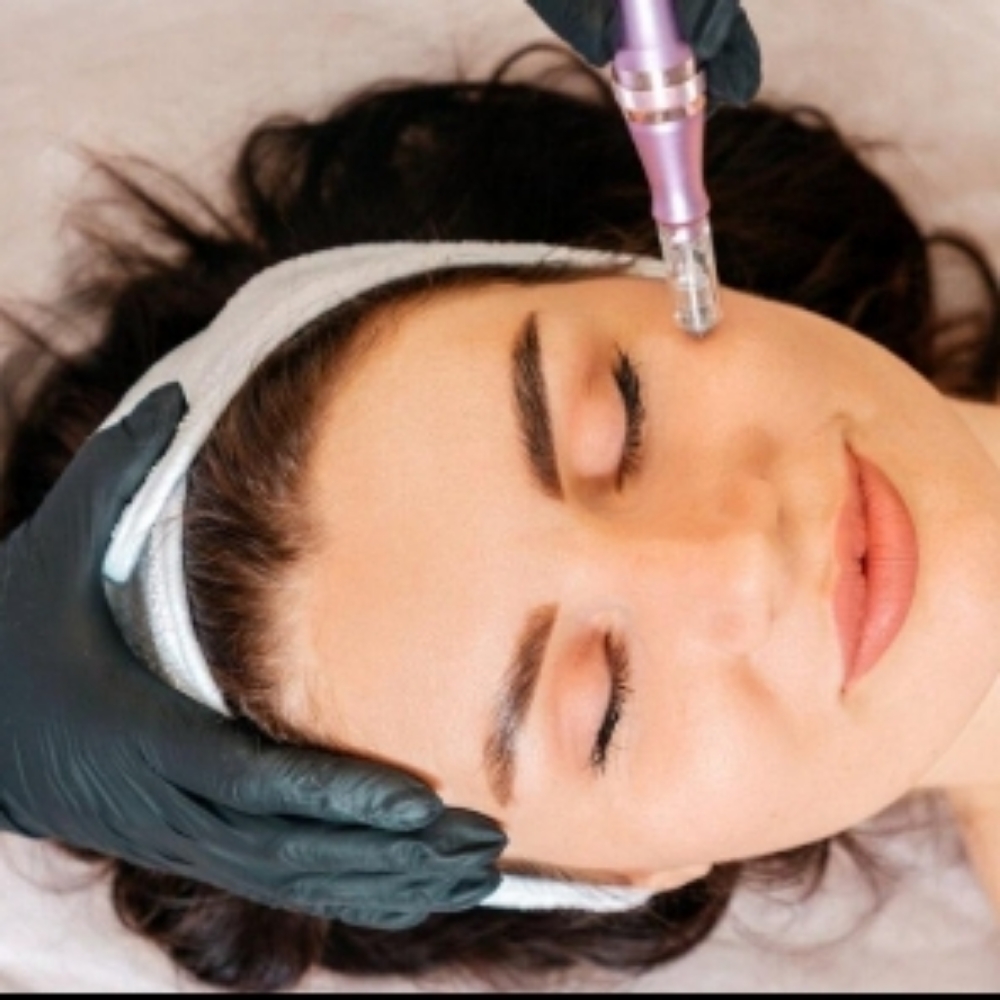 Microneedling at Timeless Soul Studio in Rush City, MN