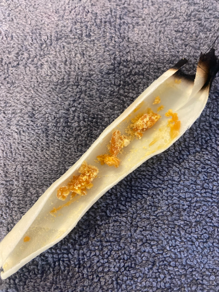 Ear Candling