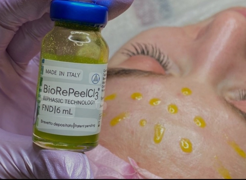 BioRePeel Cl3 at Soluna Studio /Beauty & Wellness in Forest Hills, NY