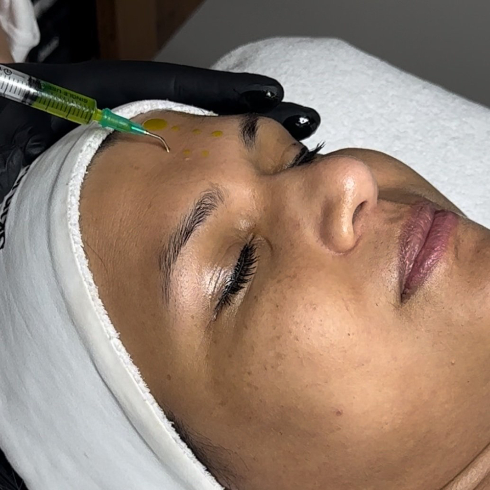 BioRePeel/Microneedle Combo