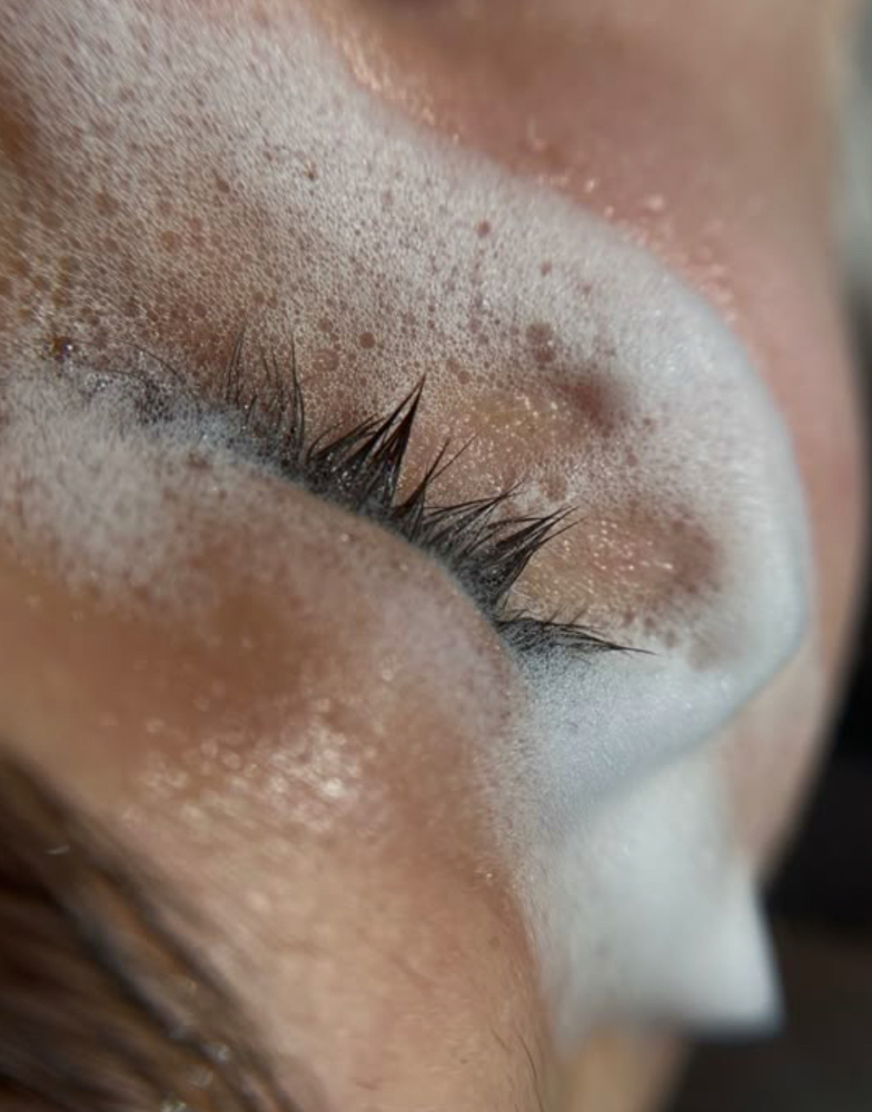 Lash Removal