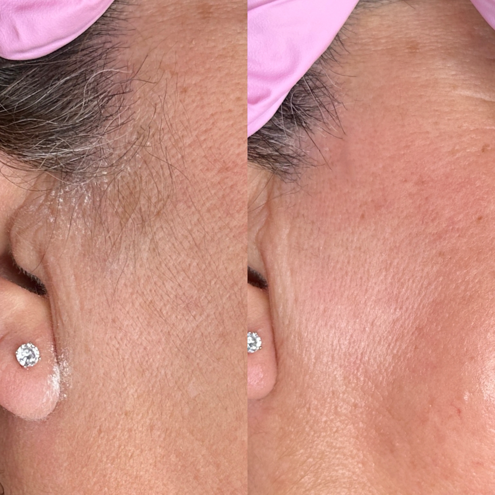 Sideburn Wax at Rose Beauty Bar | LLC in Lewisville, TX