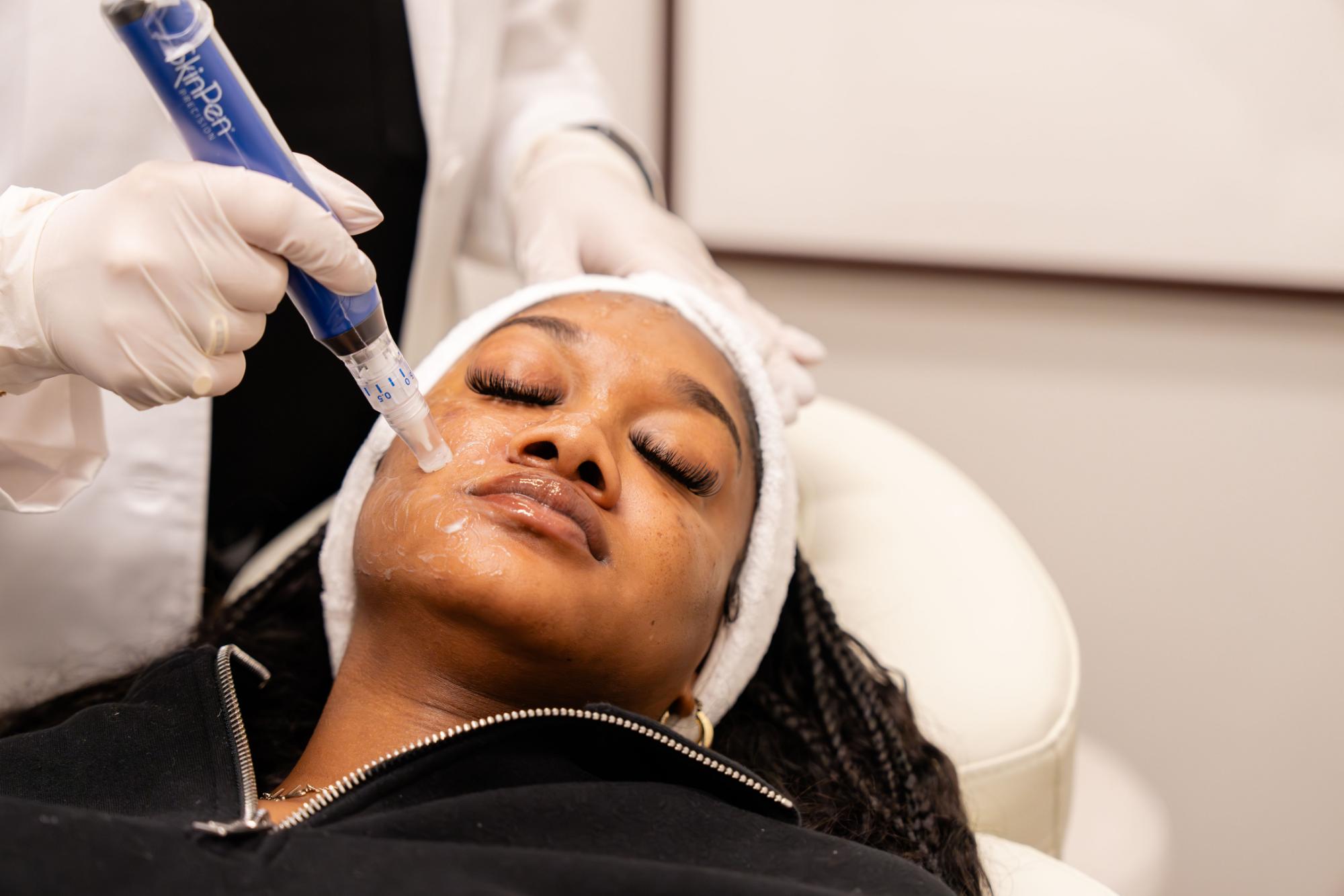 Microneedling Therapy