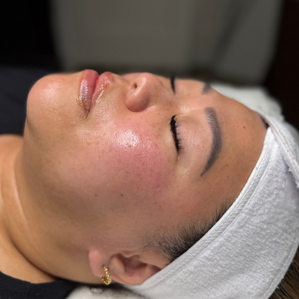 Express Dermaplaning at Floraison Beauty in Vacaville, CA