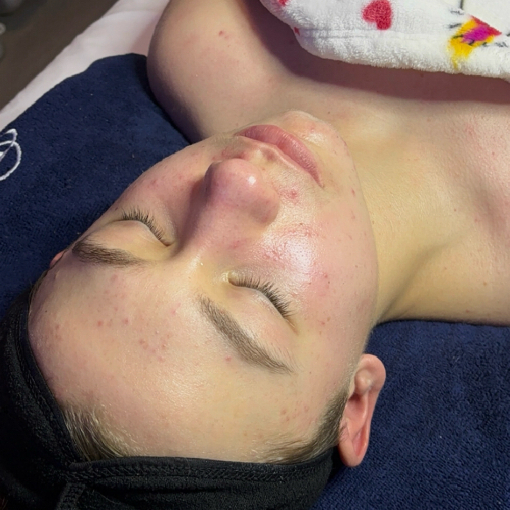 Teen Facial Special at LumiNess Lash & Wax in Sussex, NJ