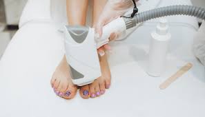 Toes Laser Hair Removal