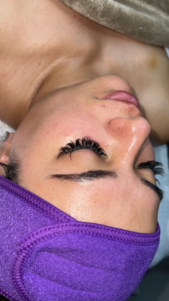 Dermaplane Facial
