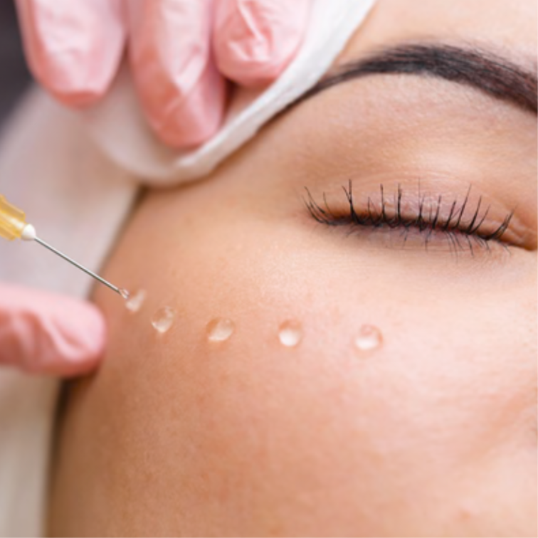 Microneedling with Salmon DNA at Skin Fix Aesthetics LA in Studio City, CA
