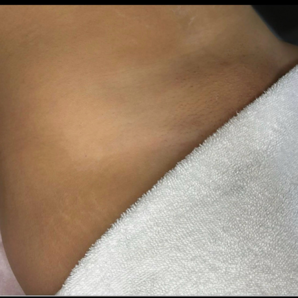 Brazilian Wax at Mi Piel Beauty Bar in Beltsville, MD
