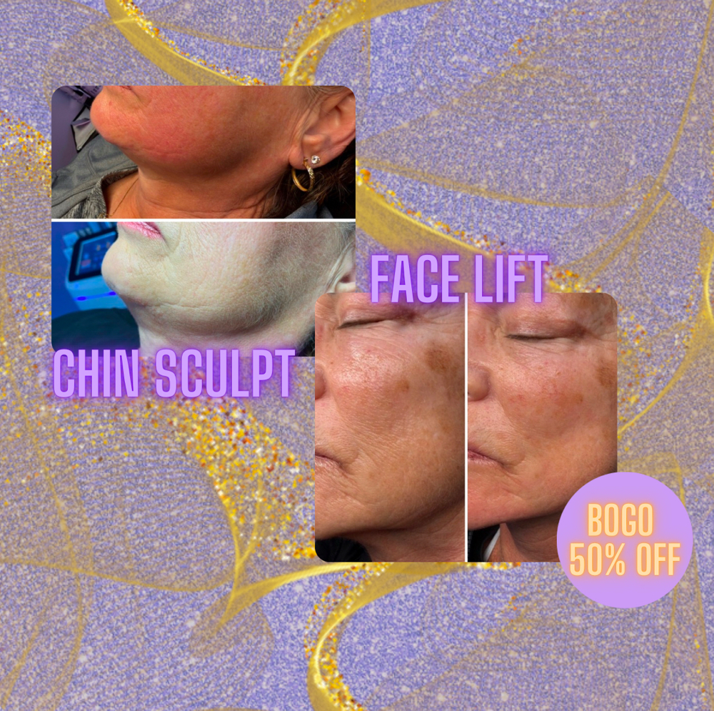 Chin & Face Lift BOGO 50% off