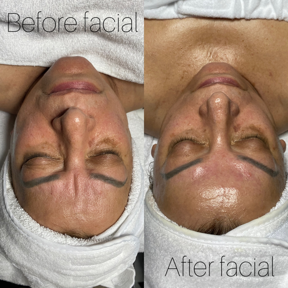 Deep Pore Cleanse Facial