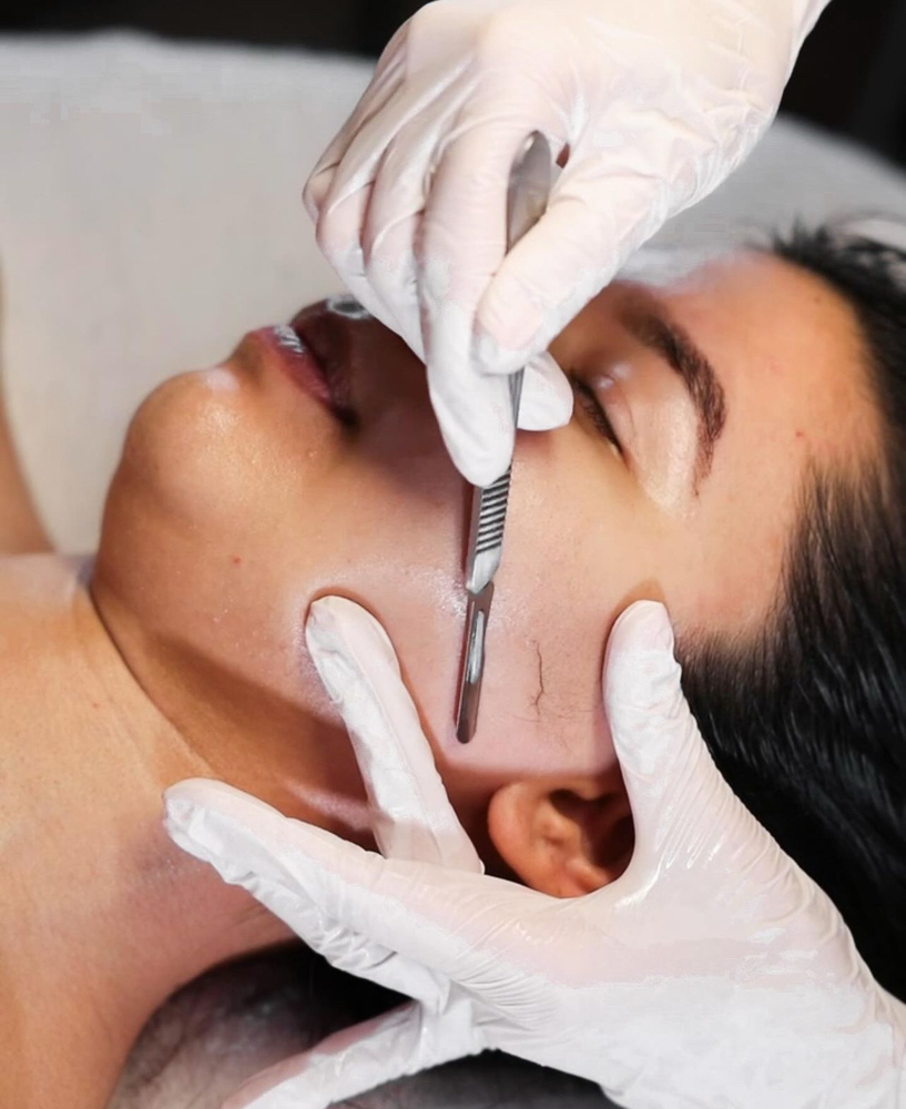 Dermaplane - ADD ON