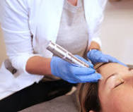 Micro-needling Facial (4)