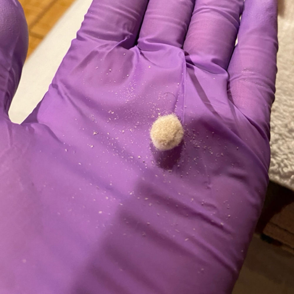 🧼 Pore Purge (Extractions) at Theirieeallureaesthetics in Warner Robins, GA