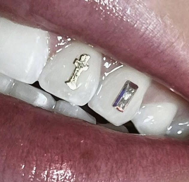 Tooth Gems (18K Gold)