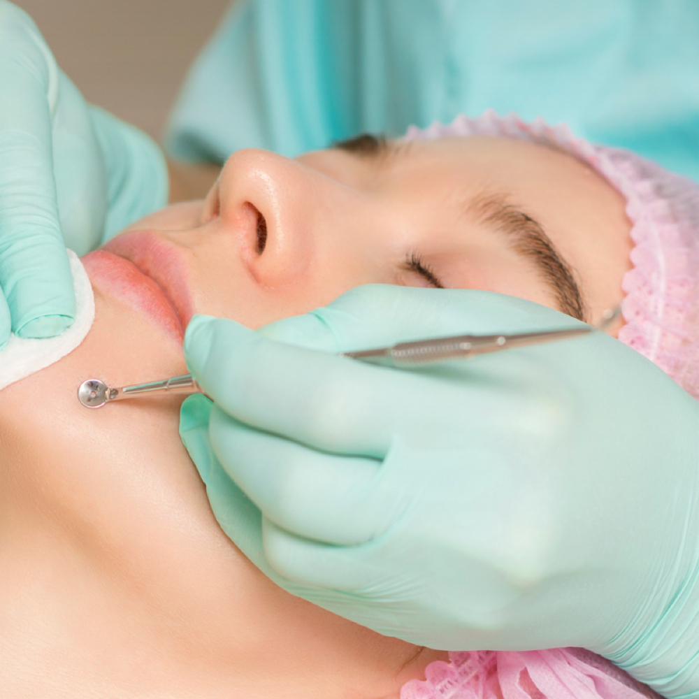 Extractions Add On at Blessed Beauty in Shreveport, LA