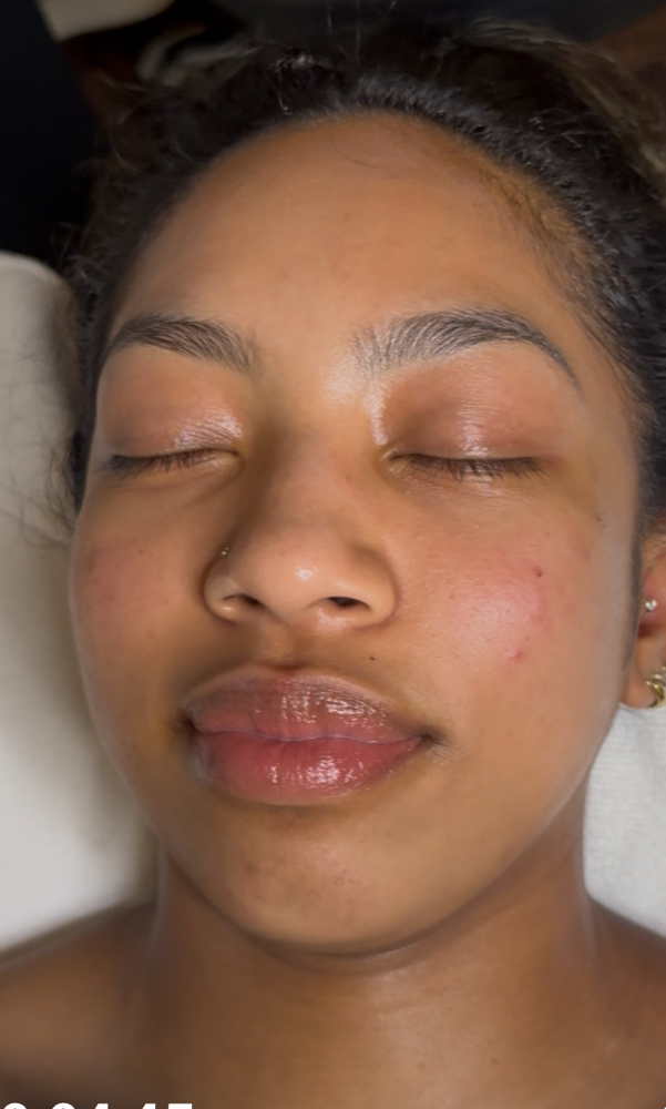 Teen Clean Facial