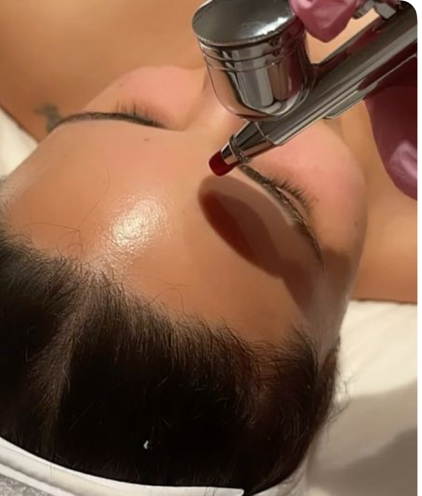 Oxygen Rx Treatment