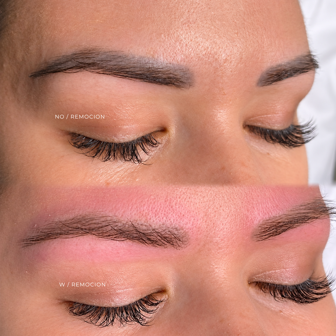 LASER | REMOCION CEJAS/ TATOO at EROXSPA in Houston, TX