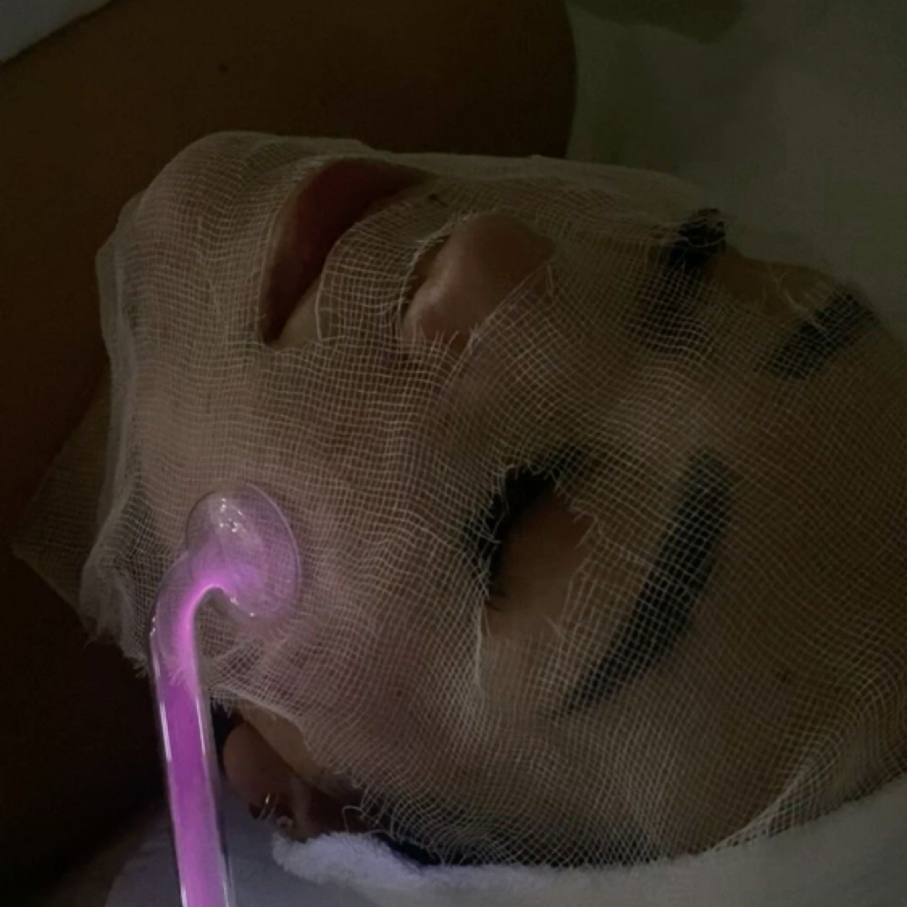 add on: High Frequency at Sol Skin Esthetics in Fort Worth, TX