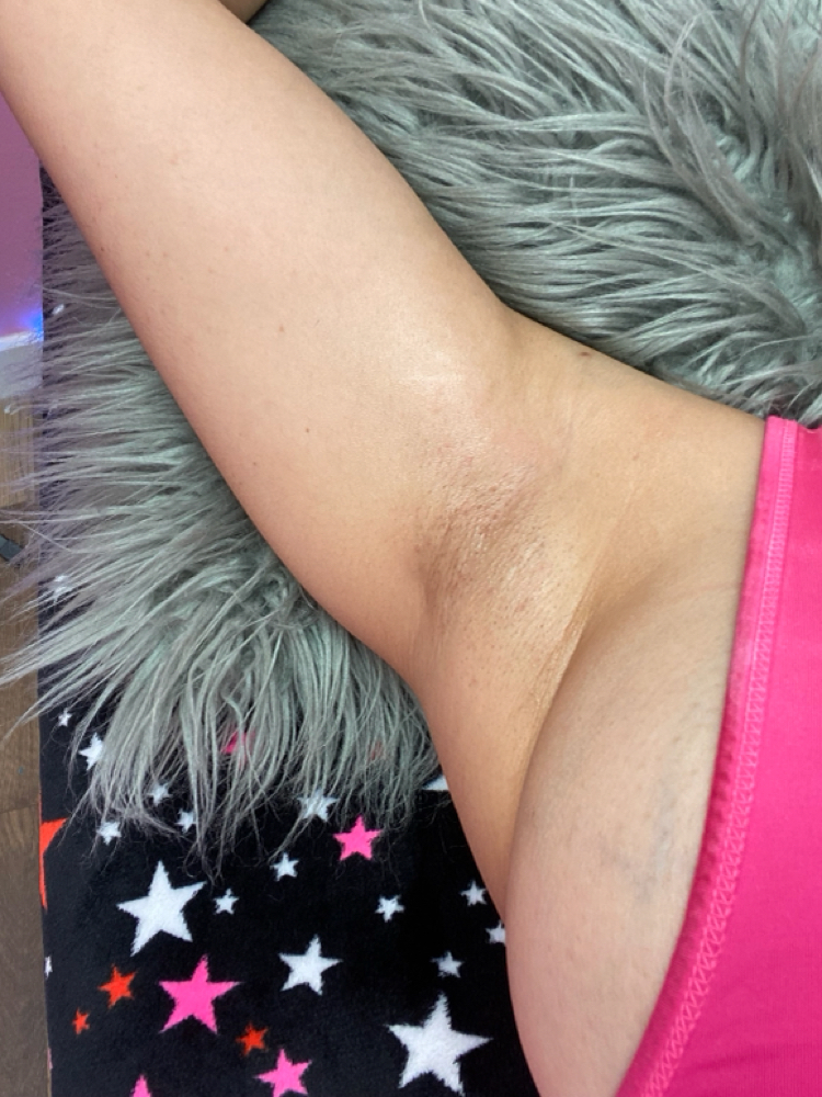 Underarm Waxing at Bare Beauty Waxing ,LLC in Bridgeport, CT