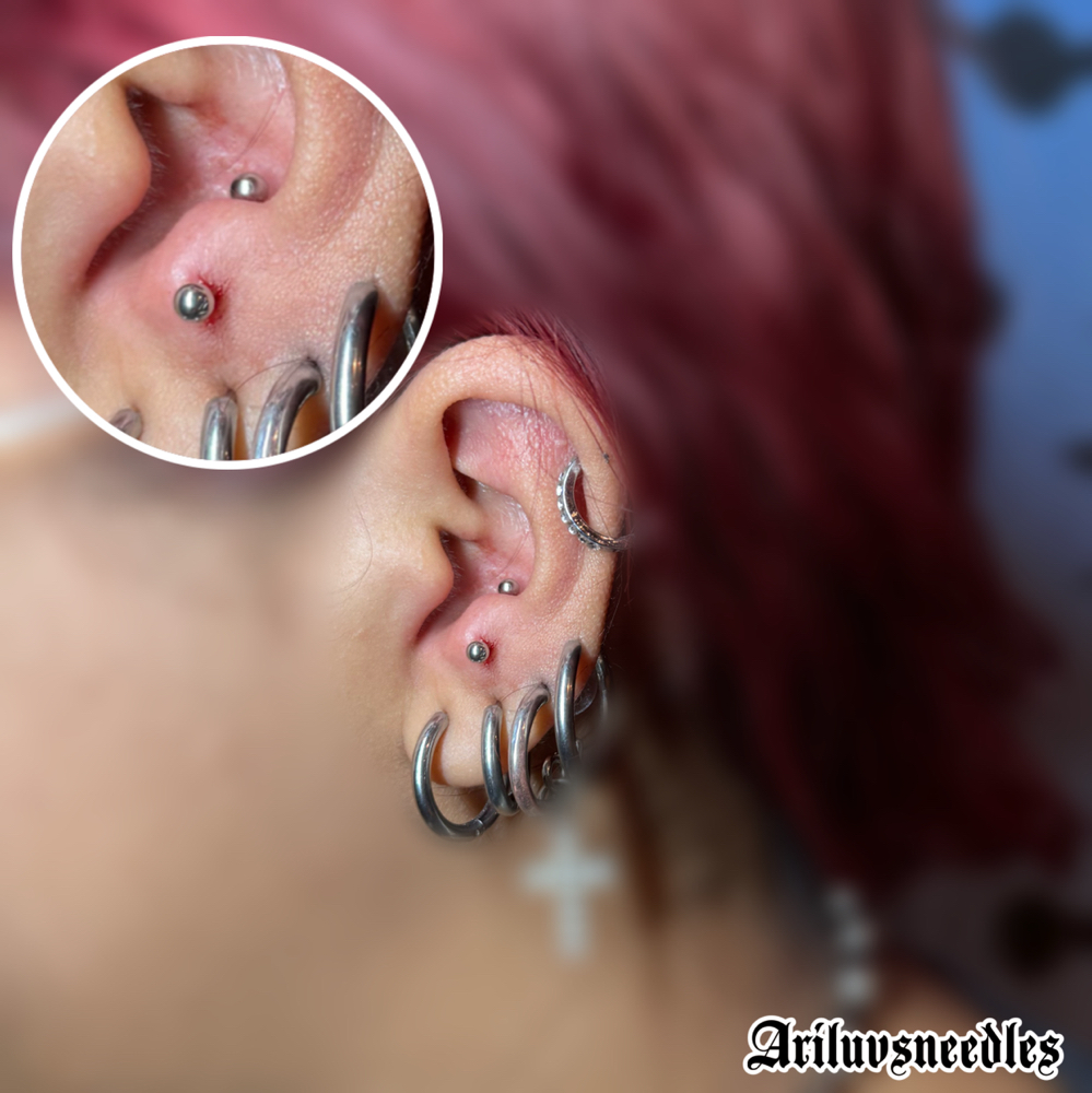 Anti-tragus